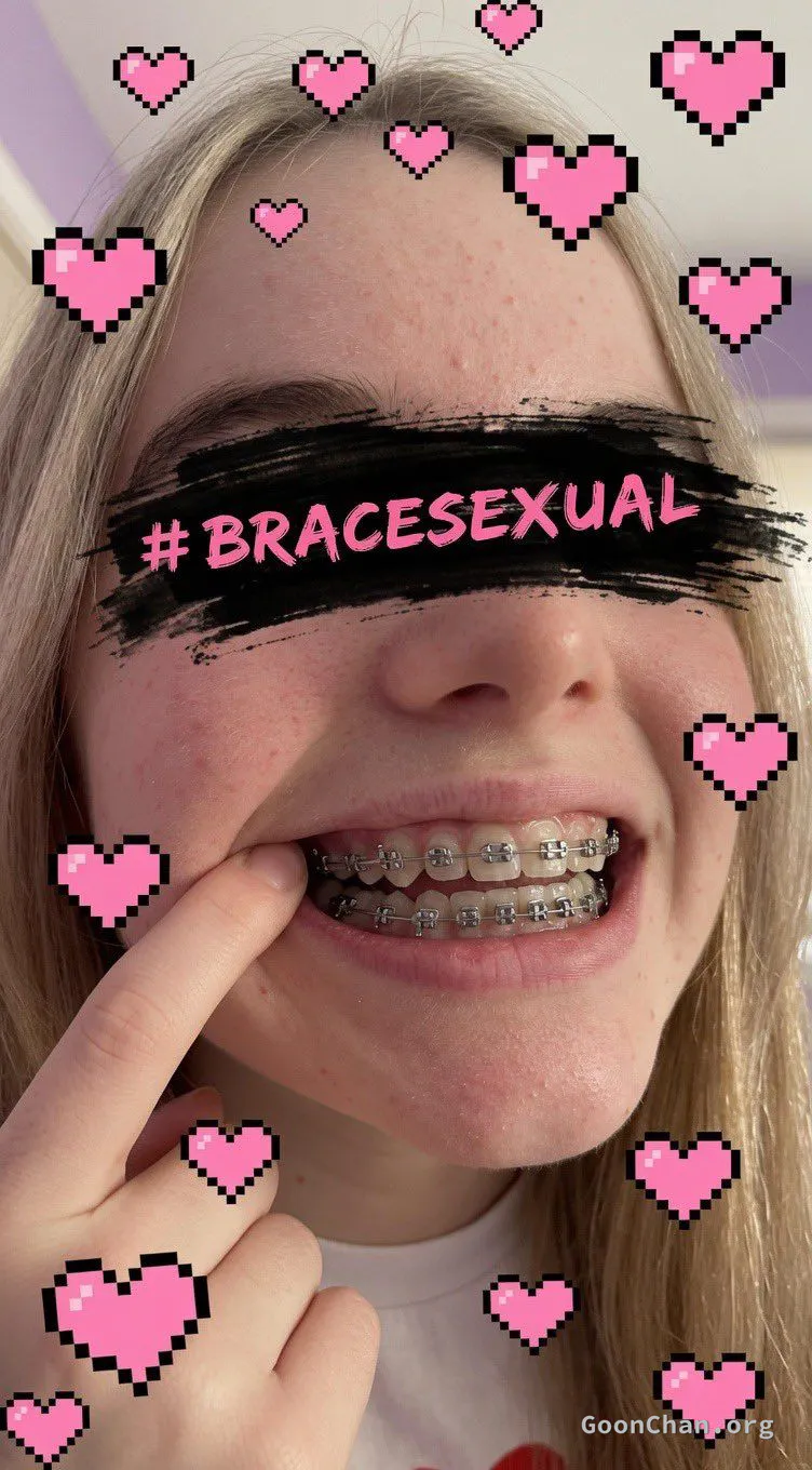 Bracesexual | brace caption - Image 1