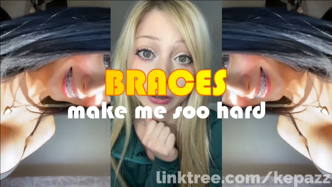 Braces Triggers Your Filthy Mind