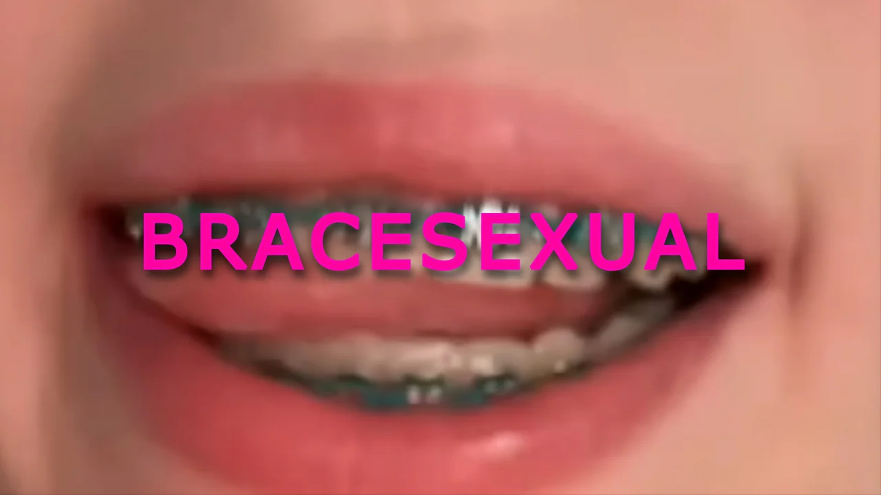 Bracesexual | Braces PMV